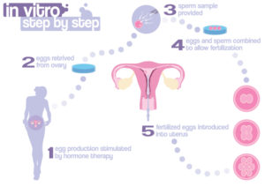 Scheme of in vitro fertilization | IVF| Andrology Corner