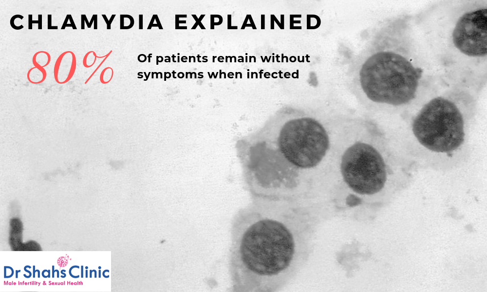 Chlamydia treatment