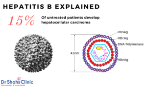 Hepatitis B treatment | Hepatitis B treatment in chennai | Hepatitis B testing in chennai