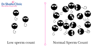sperm test | semen analysis | semen analysis test in chennai
