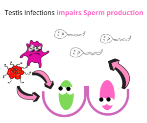 testicular infections lead to low sperm count