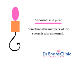 abnormal mid piece sperm