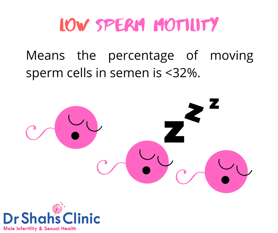 Slow Sperm