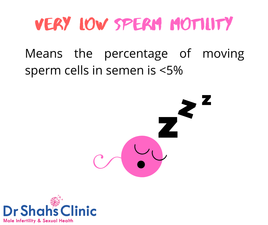 Motility Range Chart