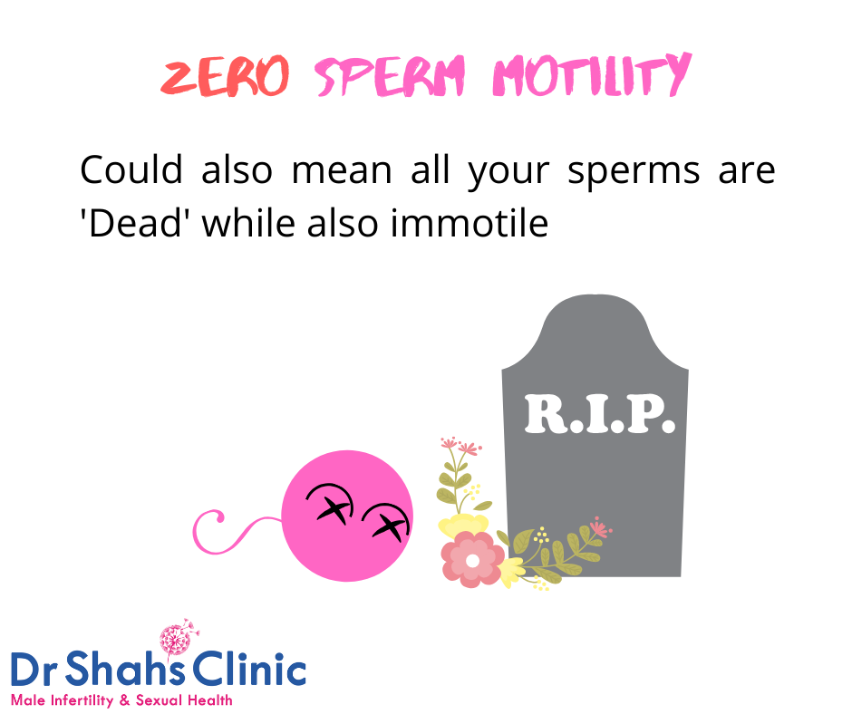 Motility Range Chart