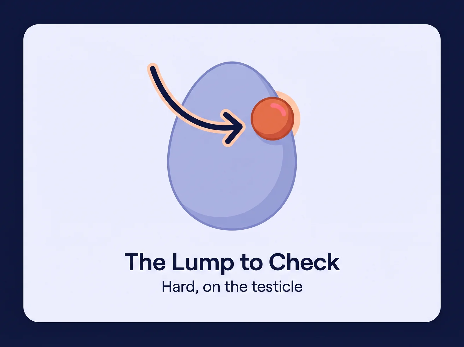 The lump to act on: hard and painless, on the testicle itself Conceptual diagram of the lump to act on — a hard, painless nodule that is part of the testicle itself, the way testicular cancer presents