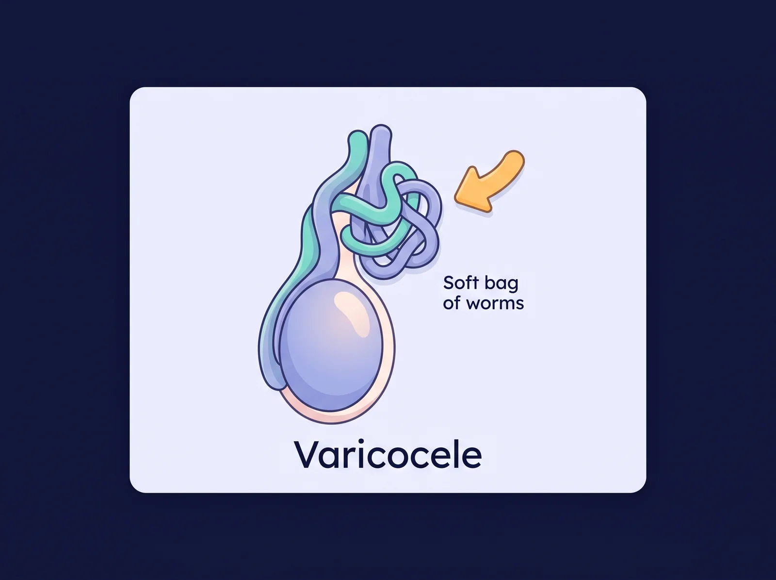 Varicocele: a soft bag of worms above the testicle Conceptual diagram of a varicocele — a soft, harmless lump on the testicle from a tangle of enlarged veins above it, the classic bag of worms