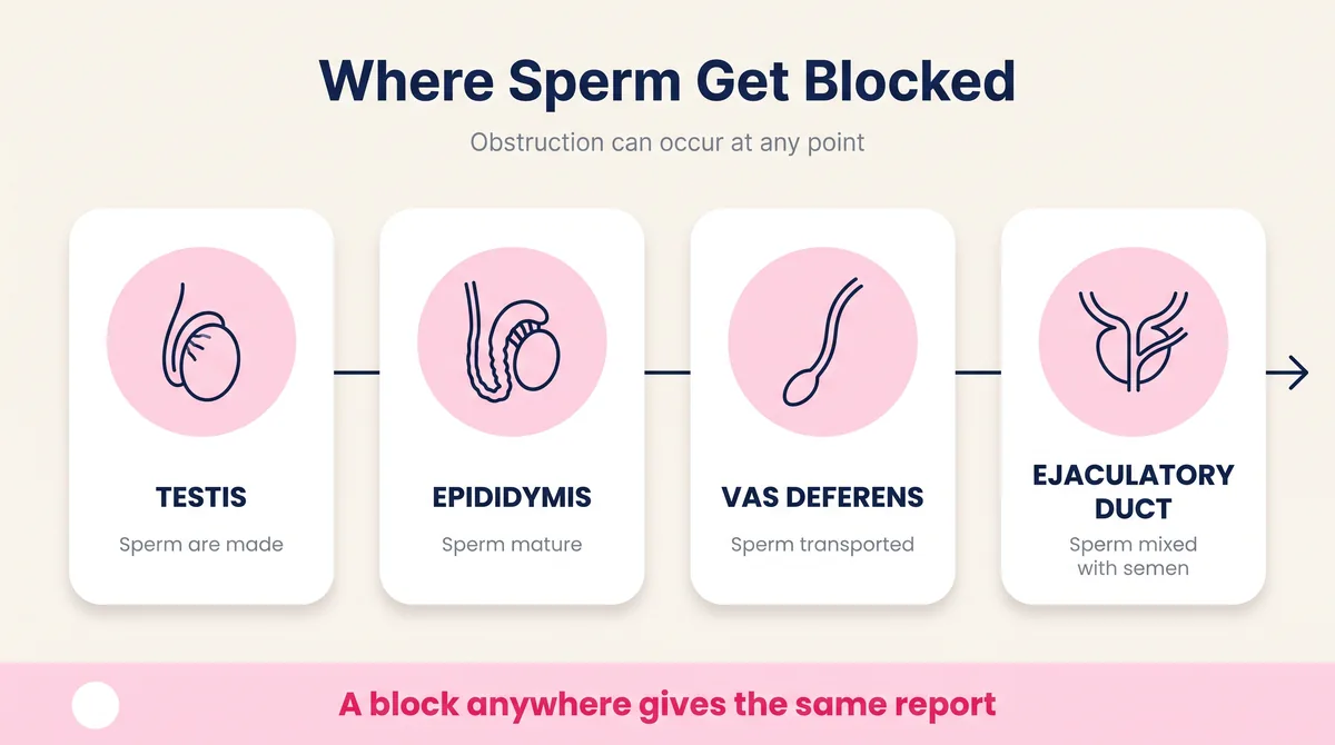 Diagram of the sperm pathway from testis to epididymis to vas deferens to ejaculatory duct, showing where an obstruction can occur