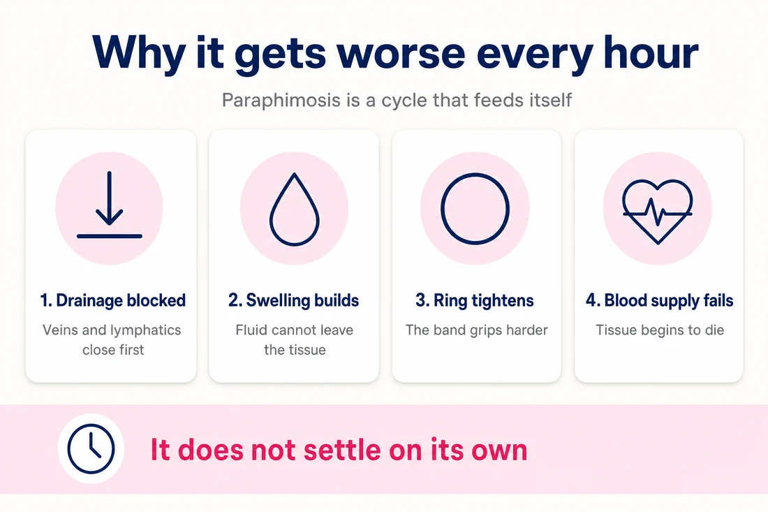 Why paraphimosis worsens every hour: drainage blocked, swelling builds, the ring tightens, blood supply fails - the cycle feeds itself and does not settle on its own